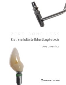 Zero Bone Loss: Knochenerhaltende Behandlungskonzepte